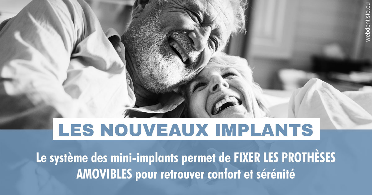 https://dr-mauger-benoit.chirurgiens-dentistes.fr/Les nouveaux implants 2