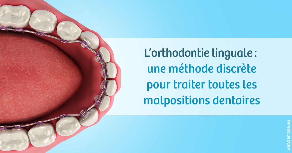 https://dr-mauger-benoit.chirurgiens-dentistes.fr/L'orthodontie linguale 1