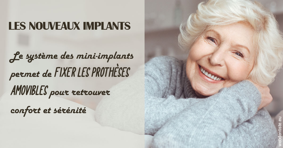 https://dr-mauger-benoit.chirurgiens-dentistes.fr/Les nouveaux implants 1