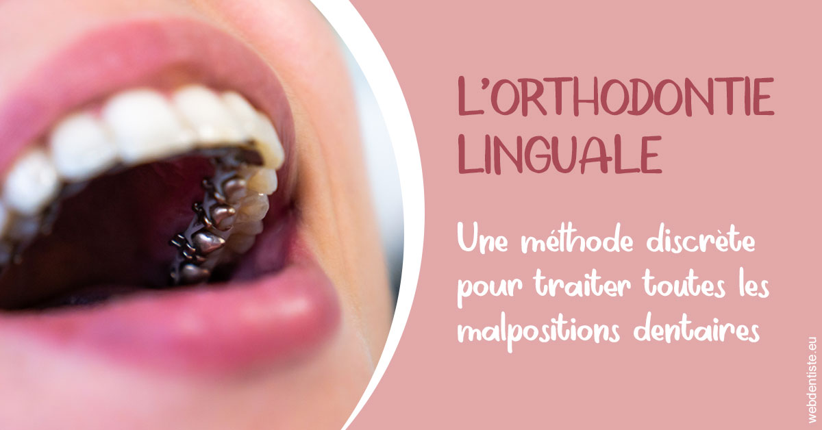 https://dr-mauger-benoit.chirurgiens-dentistes.fr/L'orthodontie linguale 2