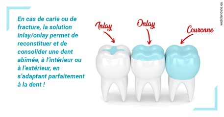 https://dr-mauger-benoit.chirurgiens-dentistes.fr/L'INLAY ou l'ONLAY