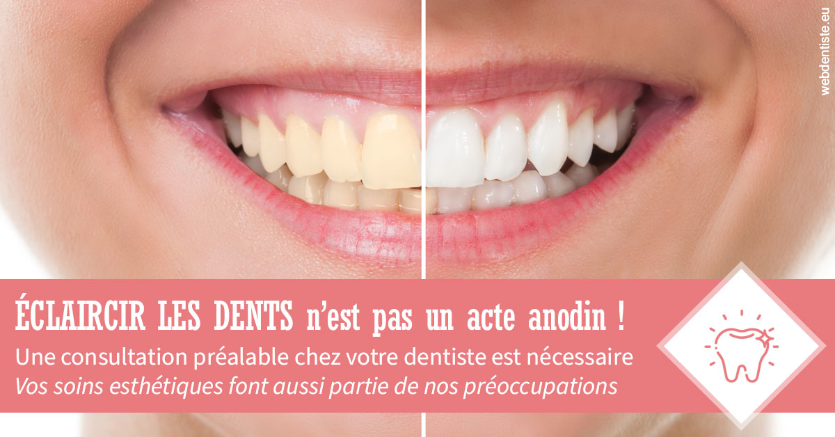 https://dr-mauger-benoit.chirurgiens-dentistes.fr/Eclaircir les dents 1
