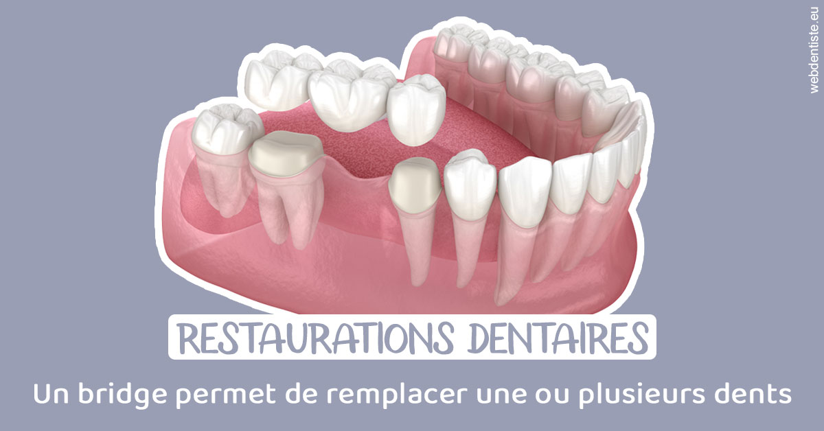 https://dr-mauger-benoit.chirurgiens-dentistes.fr/Bridge remplacer dents 1