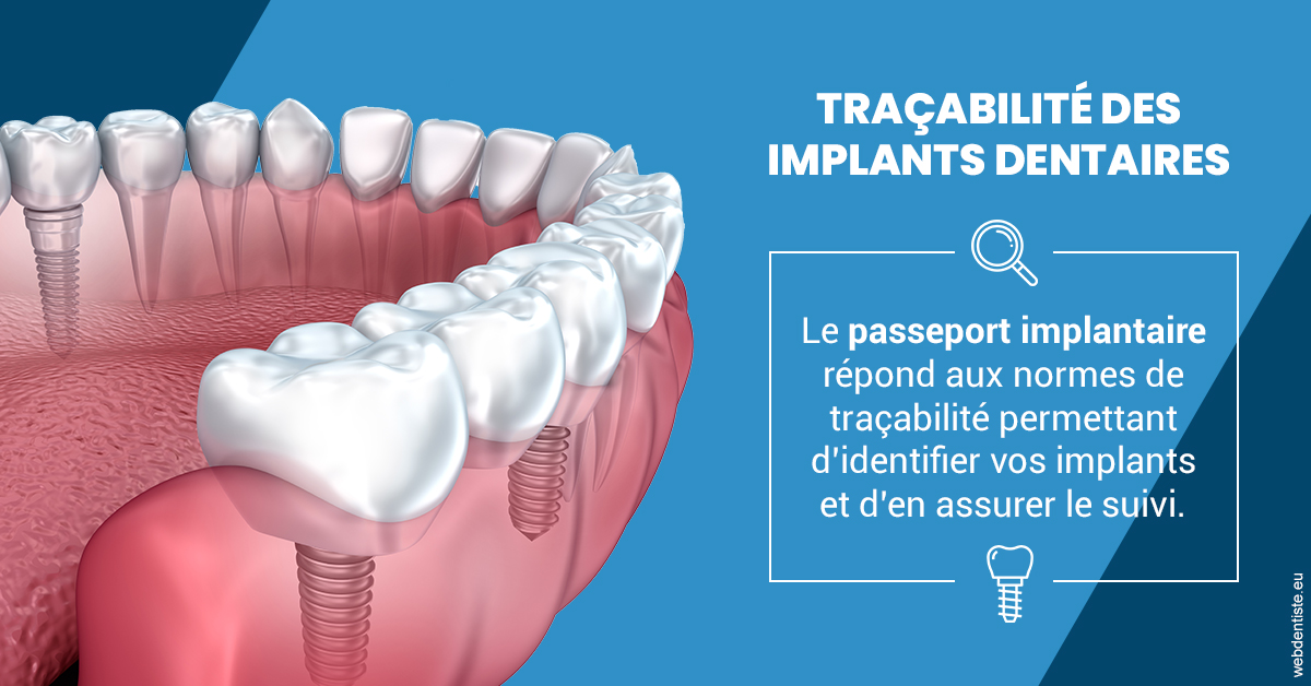 https://dr-mauger-benoit.chirurgiens-dentistes.fr/T2 2023 - Traçabilité des implants 1