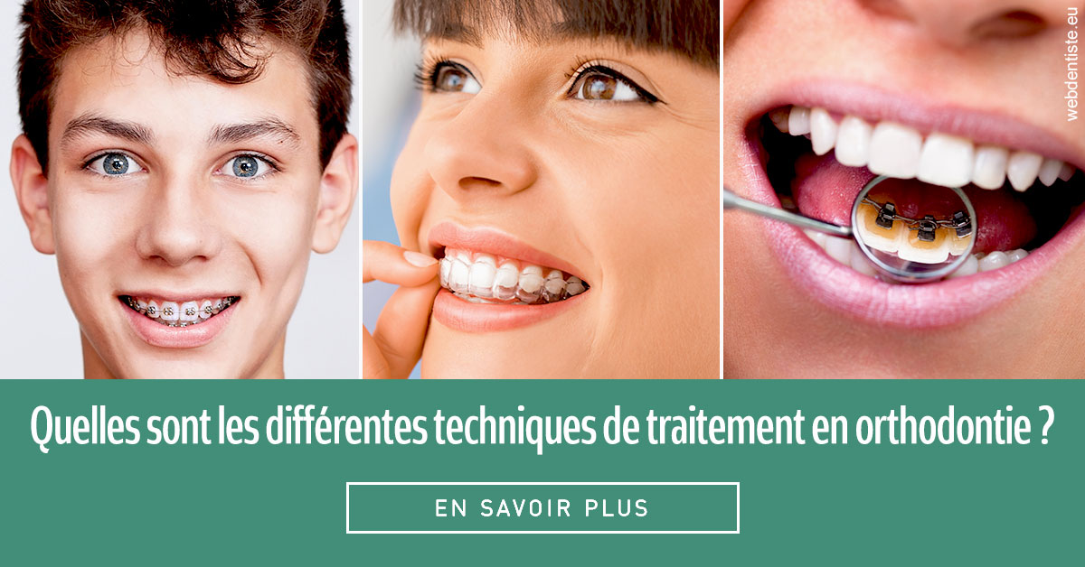 https://dr-mauger-benoit.chirurgiens-dentistes.fr/Les différentes techniques de traitement 2
