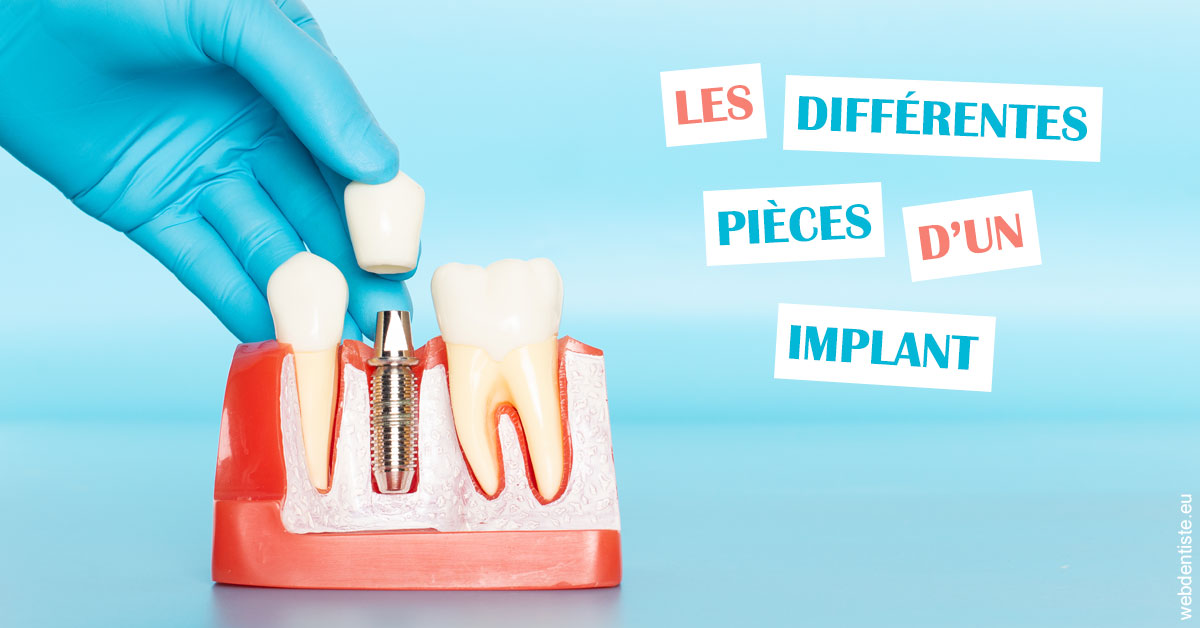 https://dr-mauger-benoit.chirurgiens-dentistes.fr/Les différentes pièces d’un implant 2