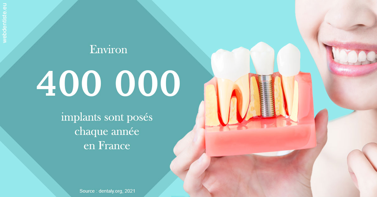 https://dr-mauger-benoit.chirurgiens-dentistes.fr/Pose d'implants en France 2