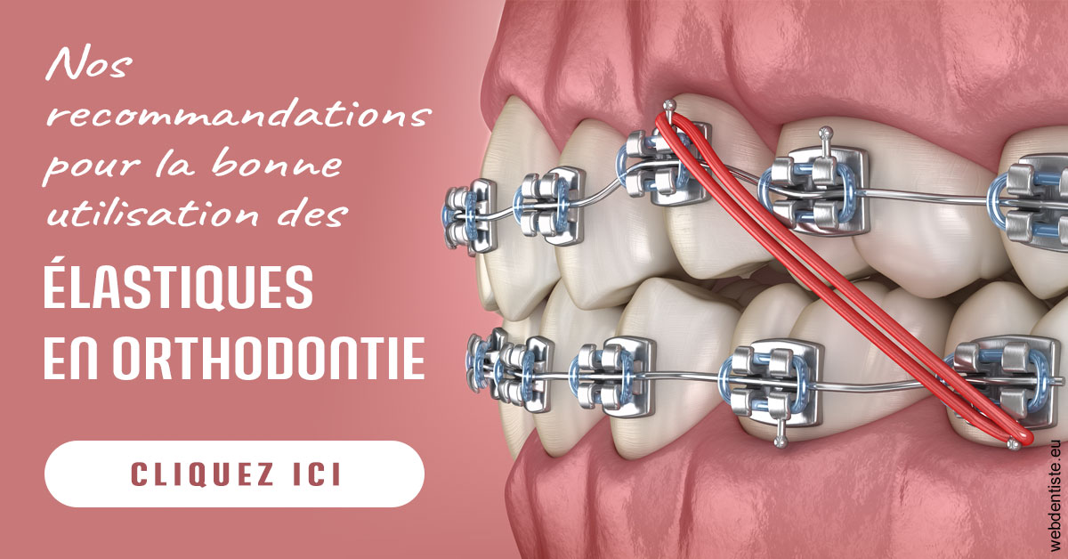 https://dr-mauger-benoit.chirurgiens-dentistes.fr/Elastiques orthodontie 2